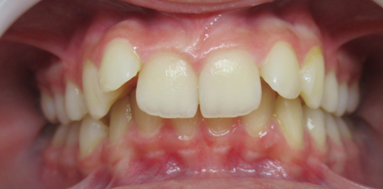 becchetti_bagues_5_1_1-1