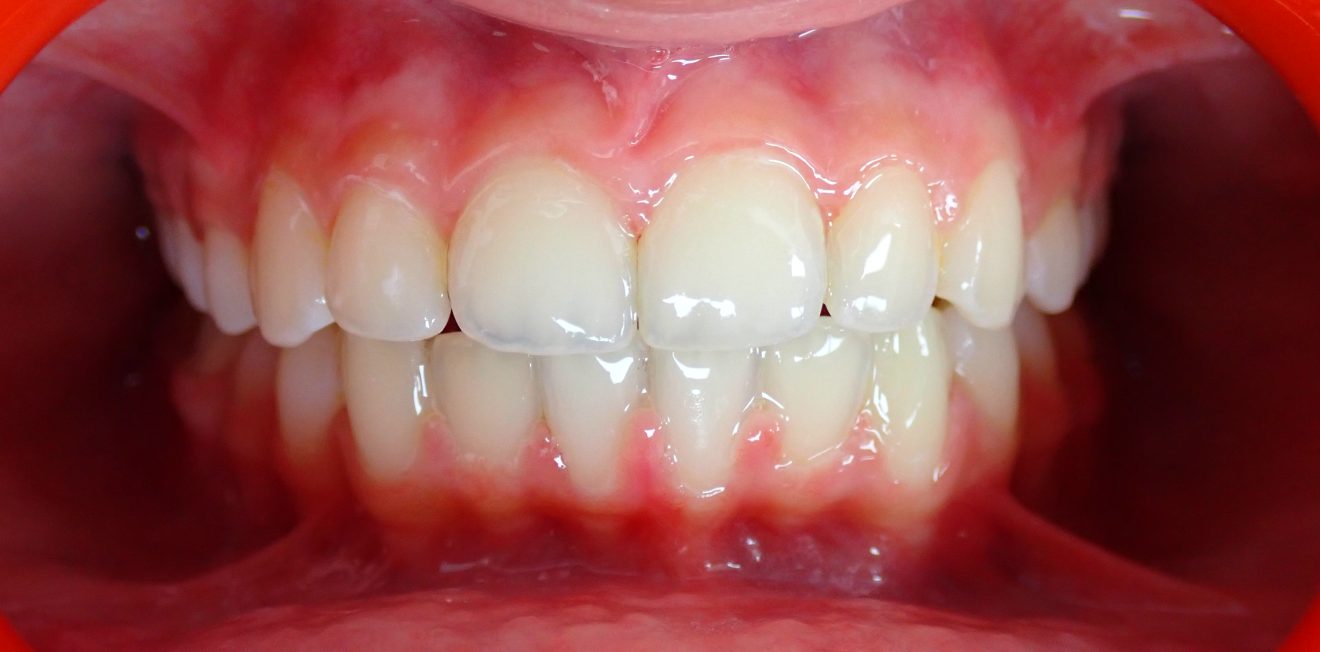 becchetti_bagues_6_1_1-1