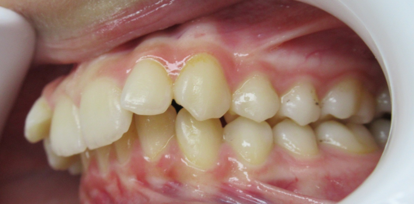 becchetti_bagues_7_1_1