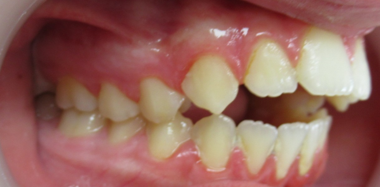 duringer_cas_chir_3_1