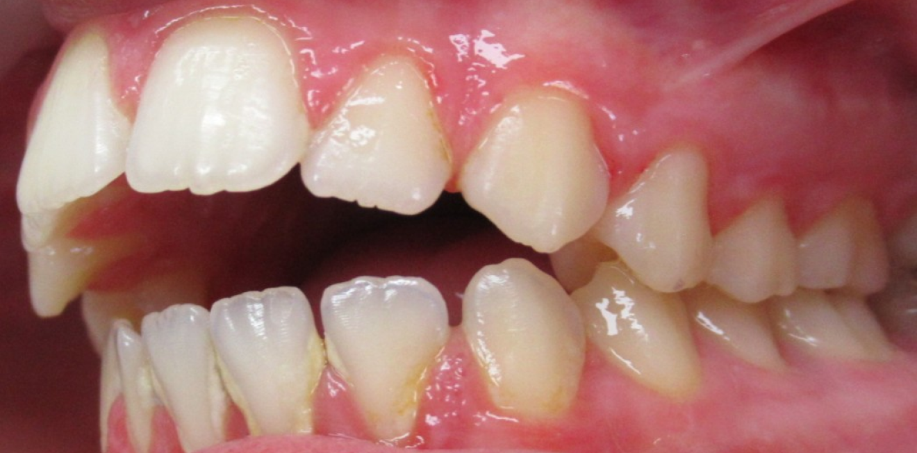 duringer_cas_chir_7_1