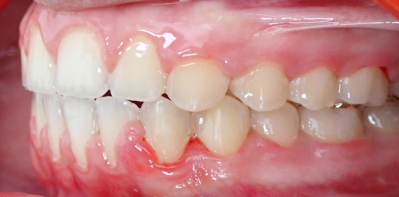 duringer_cas_chir_8_1