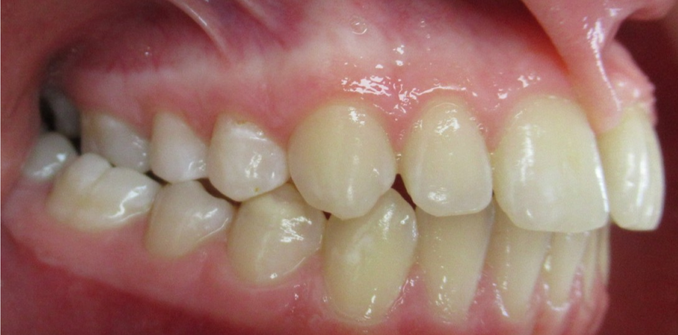 pulcinschi_bagues_3_1