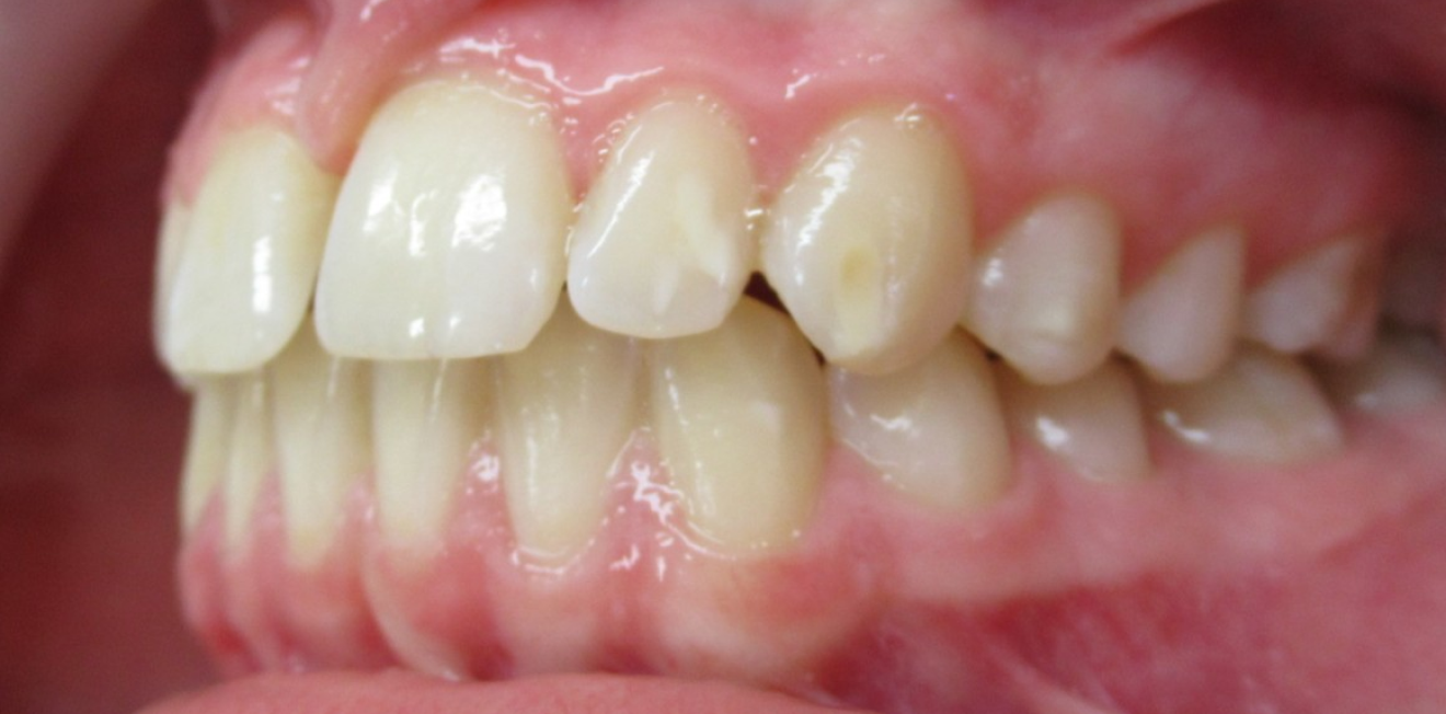 pulcinschi_bagues_7_1