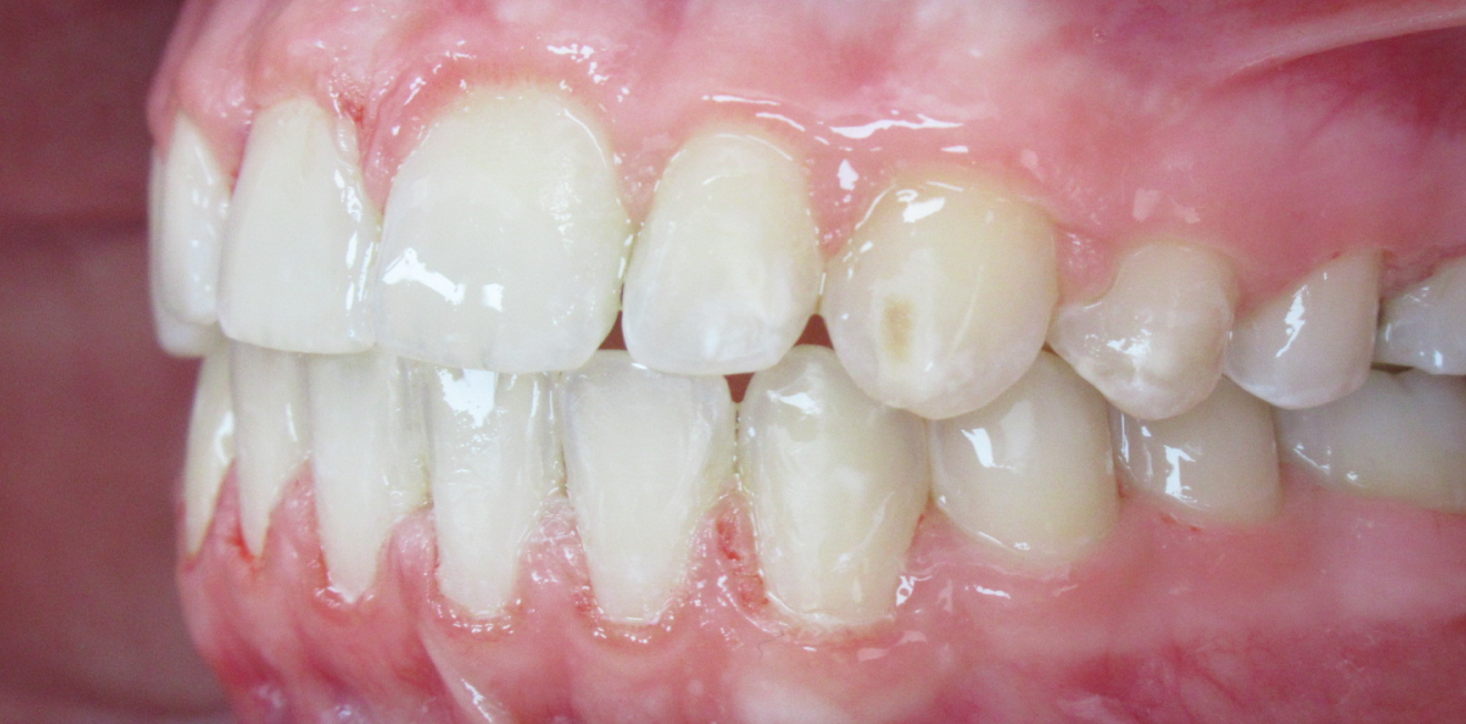 pulcinschi_bagues_8_1